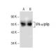 western blotting image from recommended IFN-α/βRβ (G-4) monoclonal antibody replacement. Image 154942