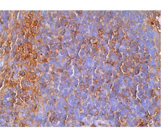 IFN-&alpha;R1 Antibody (MAR1-5A3) - Immunohistochemistry - Image 386558 