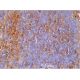 IFN-αR1 Antibody (MAR1-5A3) - Immunohistochemistry - Image 386558 