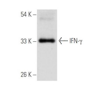 IFN-&gamma;/Interferon gamma Antibody (B27) - Western Blotting - Image 17785