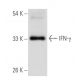 IFN-γ/Interferon gamma Antibody (B27) - Western Blotting - Image 17785
