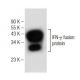 这种多克隆抗体已经停产。请参阅我们推荐的<a href="ifn-gamma-antibody-e-10">IFN-γ/Interferon gamma (E-10)</a>单克隆抗体(显示样本数据)。 western blotting image from recommended IFN-γ/Interferon gamma (E-10) monoclonal antibody replacement. Image 146558