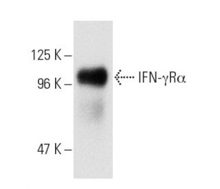 IFN-&gamma;R&alpha; Antibody (2E2) - Western Blotting - Image 2963 