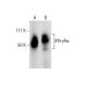 western blotting image from recommended IFN-γRα (GIR-94) monoclonal antibody replacement. Image 284356