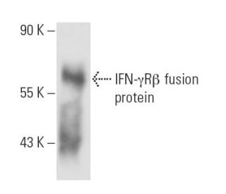 IFN-&gamma;R&beta; Antibody (2 HUB 145) - Western Blotting - Image 16441