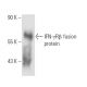 IFN-γRβ Antibody (2 HUB 145) - Western Blotting - Image 16441