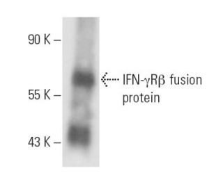 IFN-&gamma;R&beta; Antibody (2 HUB 159) - Western Blotting - Image 16440