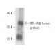 IFN-γRβ Antibody (2 HUB 159) - Western Blotting - Image 16440