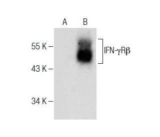 western blotting image from recommended IFN-γRβ (A-11) monoclonal antibody replacement. Image 283450