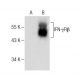 Este anticorpo policlonal foi descontinuado. Consulta o nosso anticorpo monoclonal <a href="ifn-gammarbeta-antibody-a-11">IFN-γRβ (A-11)</a> recomendado (dados de amostra apresentados). western blotting image from recommended IFN-γRβ (A-11) monoclonal antibody replacement. Image 283450