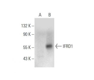 IFRD1 Antibody (D-7) - Western Blotting - Image 333712The Double Nickase Plasmid features a U6 promoter for sgRNA expression, a 20 nt targeting sequence, and a gRNA scaffold to guide Cas9n. It includes a CBh promoter for Cas9n (D10A) and puromycin resistance, GFP for transfection verification, and nuclear localization signals (NLS). The 2A peptide allows co-expression of Cas9n and Puro from a single promoter, enabling precise genome editing with reduced off-target effects.