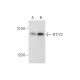 IFT172 Antibody (A-11) - Western Blotting - Image 304324