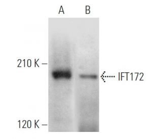 IFT172 Antibody (A-11) - Western Blotting - Image 369870 