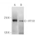 IFT172 Antibody (A-11) - Western Blotting - Image 369870 