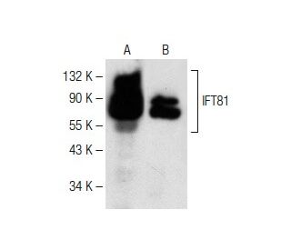 IFT81 Antibody (A-3) - Western Blotting - Image 149631 