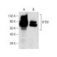 IFT81 Antibody (A-3) - Western Blotting - Image 149631 