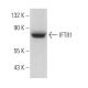 IFT81 Antibody (A-3) - Western Blotting - Image 366933 