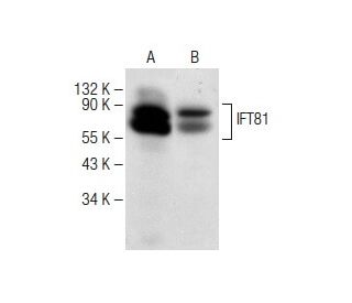 IFT81 Antibody (B-8) - Western Blotting - Image 149632 