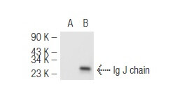 J Chain Anti-Ig J chain Antibody (F-12) | SCBT - Santa Cruz Biotechnology