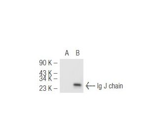 Ig J chain (F-12): sc-133177. Western blot analysis of Ig...