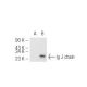 Ig J chain (F-12): sc-133177. Western blot analysis of Ig...