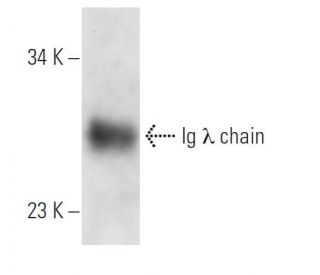 Ig &lambda; chain Antibody (Rs4) - Western Blotting - Image 14009 