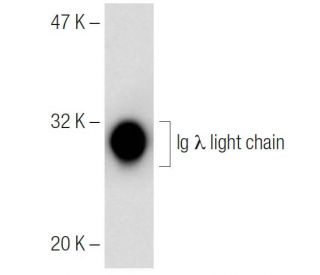 Ig &lambda; light chain Antibody (A2A-5) - Western Blotting - Image 141637 