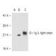 Ig λ light chain Antibody (JDC-12) - Western Blotting - Image 43193