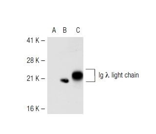 Ig &lambda; light chain Antibody (mAHuIgL) - Western Blotting - Image 43195 