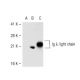 Ig λ light chain Antibody (mAHuIgL) - Western Blotting - Image 43195 