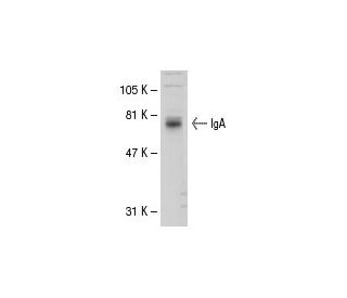 IgA Antibody (A2A-13) - Western Blotting - Image 31421