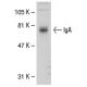 IgA Antibody (A2A-13) - Western Blotting - Image 31421