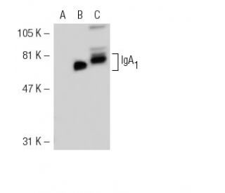 IgA Antibody (mAHuIgA-1&2) - Western Blotting - Image 31426