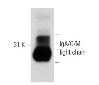 IgA/G/M light chain Antibody (7A9) - Western Blotting - Image 31428