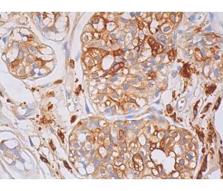 IgA<sub>1</sub> Antibody (H-11) - Immunohistochemistry - Image 392186 