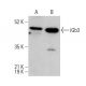 iGb3 Antibody (H-7) - Western Blotting - Image 375614 