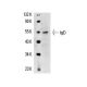 IgD Antibody (AMS 9.1) - Western Blotting - Image 14646