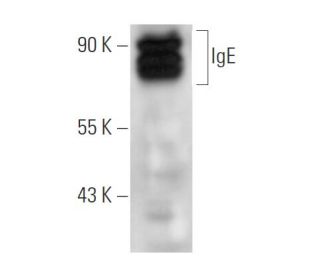 IgE Antibody (154/102) - Western Blotting - Image 14642