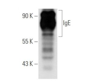 IgE Antibody (MH25-1) - Western Blotting - Image 14645