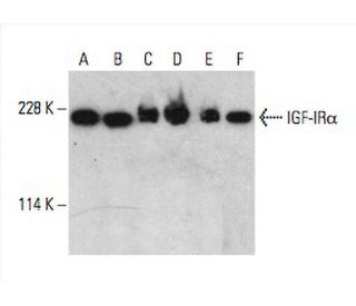 IGF-1 Receptor α/IGF1R Antibody (2C8) - Western Blotting - Image 392586