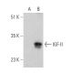 This polyclonal antibody has been discontinued. See our recommended <a href="igf-ii-antibody-h-11">IGF-II (H-11)</a> monoclonal antibody (sample data shown). western blotting image from recommended IGF-II (H-11) monoclonal antibody replacement. Image 366628