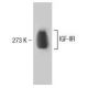 IGF2R/M6PR Antibody (29) - Western Blotting - Image 138220 