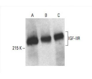 western blotting image from recommended IGF2R/M6PR (29) monoclonal antibody replacement. Image 392957
