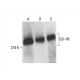 western blotting image from recommended IGF2R/M6PR (29) monoclonal antibody replacement. Image 392957