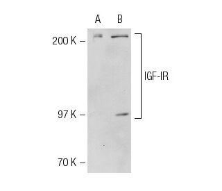 IGF-1 Receptor/IGF1R Antibody (7G11) - Western Blotting - Image 22049