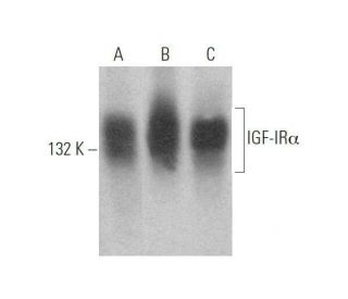 IGF-1 Receptor &alpha;/IGF1R Antibody (G-5) - Western Blotting - Image 353360 