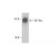 western blotting image from recommended IGF-1 Receptor α/IGF1R (G-5) monoclonal antibody replacement. Image 353358