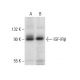 IGF-1 Receptor β/IGF1R Antibody (D-11) - Western Blotting - Image 303466 
