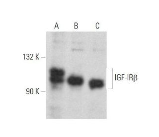 IGF-1 Receptor &beta;/IGF1R Antibody (D-11) - Western Blotting - Image 353164 