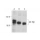 IGF-1 Receptor β/IGF1R Antibody (D-11) - Western Blotting - Image 353164 